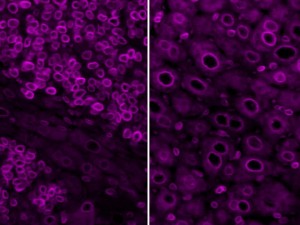 Nuclear envelopes of cells in Tumors and in Normal Liver (image by Jerome Irianto).